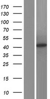 ACAT1 Human Over-expression Lysate