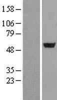 Adenylosuccinate Lyase (ADSL) Human Over-expression Lysate