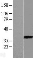 ASPA Human Over-expression Lysate