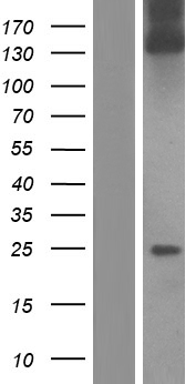 Collagen I (COL1A1) Human Over-expression Lysate