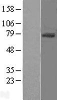 CD105 (ENG) Human Over-expression Lysate