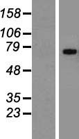 CD42b (GP1BA) Human Over-expression Lysate