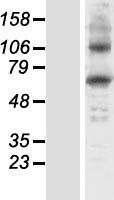 HGD Human Over-expression Lysate