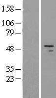 HADHB Human Over-expression Lysate