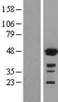 Glutathione Synthetase (GSS) Human Over-expression Lysate