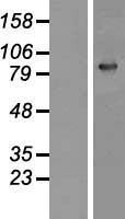 Gelsolin (GSN) Human Over-expression Lysate