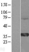 HMGCL Human Over-expression Lysate