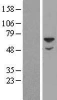 SGSH Human Over-expression Lysate
