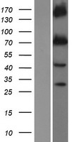 KCNQ1 Human Over-expression Lysate