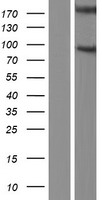 Nephronophthisis (NPHP1) Human Over-expression Lysate