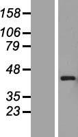 PEX12 Human Over-expression Lysate