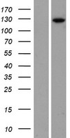 Phosphorylase B (PHKB) Human Over-expression Lysate