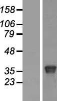 BRN4 (POU3F4) Human Over-expression Lysate