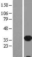 CRALBP (RLBP1) Human Over-expression Lysate
