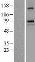 SCNN1B Human Over-expression Lysate
