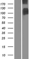 Band 3 (SLC4A1) Human Over-expression Lysate