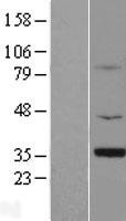 SMN1 Human Over-expression Lysate