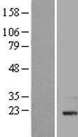 STAR Human Over-expression Lysate