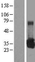 UROS Human Over-expression Lysate