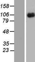 IL3RB (CSF2RB) Human Over-expression Lysate