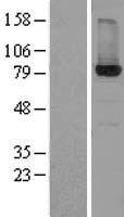 Hydroxysteroid (17 beta) Dehydrogenase 4 (HSD17B4)Human Over-expression Lysate