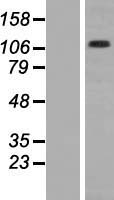 CD41 (ITGA2B) Human Over-expression Lysate