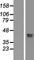 HFE Human Over-expression Lysate