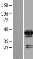 MVK Human Over-expression Lysate