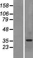 SLC10A2 Human Over-expression Lysate