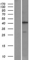 Aminomethyltransferase (AMT) Human Over-expression Lysate