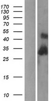 C1QB Human Over-expression Lysate