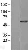 GALNS Human Over-expression Lysate