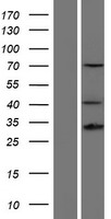 HOXD13 Human Over-expression Lysate