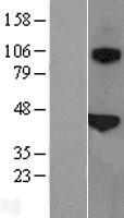 SFTPB Human Over-expression Lysate