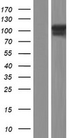 Thyroid Peroxidase (TPO) Human Over-expression Lysate