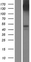 CCR5 Human Over-expression Lysate