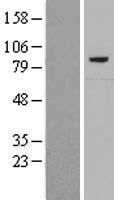 Complement C7 (C7) Human Over-expression Lysate