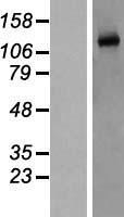 eNOS (NOS3) Human Over-expression Lysate