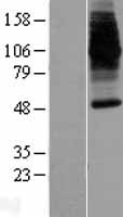 DMT1 (SLC11A2) Human Over-expression Lysate