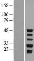 Protein C inhibitor (SERPINA5) Human Over-expression Lysate