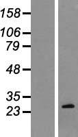 BCL2 Human Over-expression Lysate