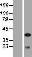 NCF4 Human Over-expression Lysate