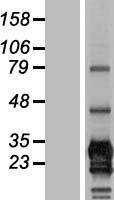 CD79B Human Over-expression Lysate