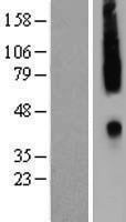 CCR2 Human Over-expression Lysate