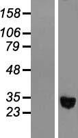 ADH1C Human Over-expression Lysate