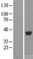 ADH1B Human Over-expression Lysate