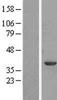 Annexin A1 (ANXA1) Human Over-expression Lysate