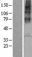 AVPR1A Human Over-expression Lysate