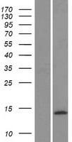 CGRP (CALCB) Human Over-expression Lysate
