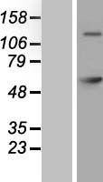 GAD65 (GAD2) Human Over-expression Lysate